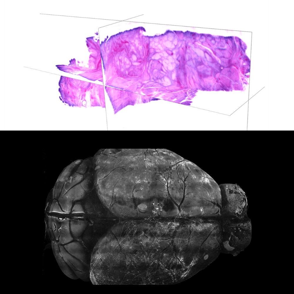 Silvestri group lightsheet data 3D histology