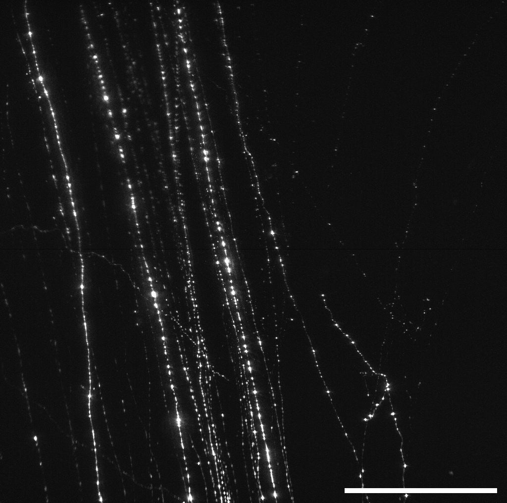Silvestri lab axons with 1 mm scalebar